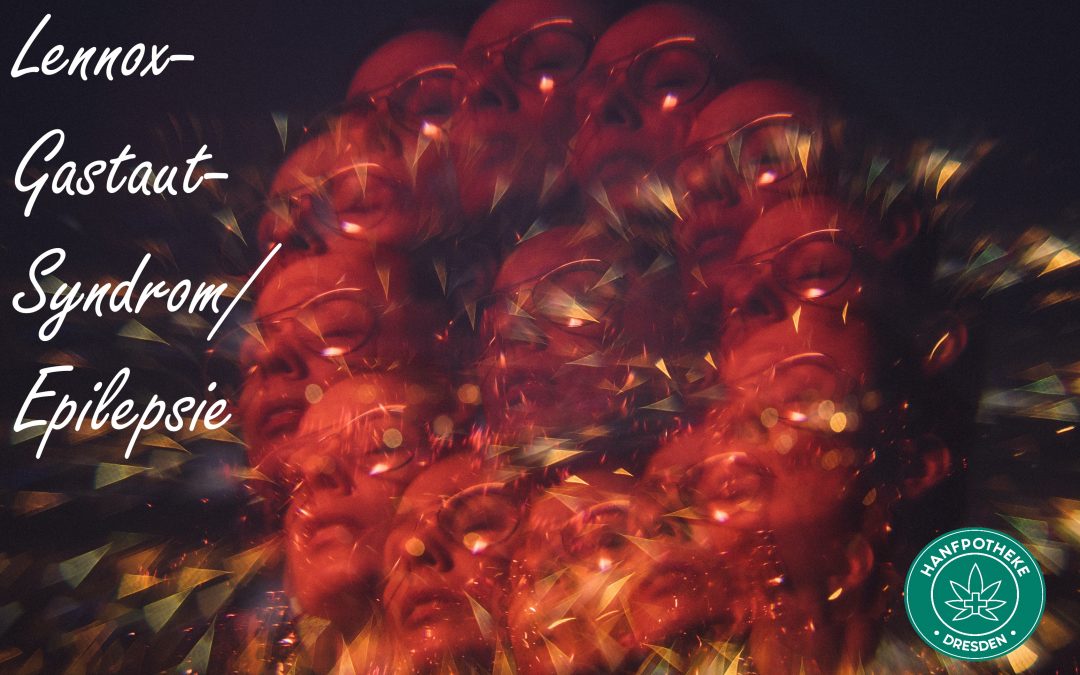 CBD vermeidet Anfälle bei Lennox-Gastaut-Syn­drom/Epilepsie